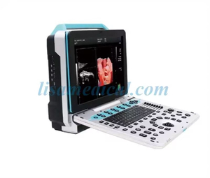 ALS-P50 Portable Color Ultrasound