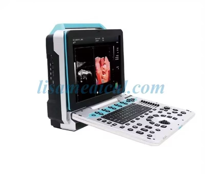 ALS-P50 Portable Color Ultrasound