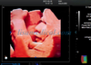 ALS-P50 Portable Color Ultrasound