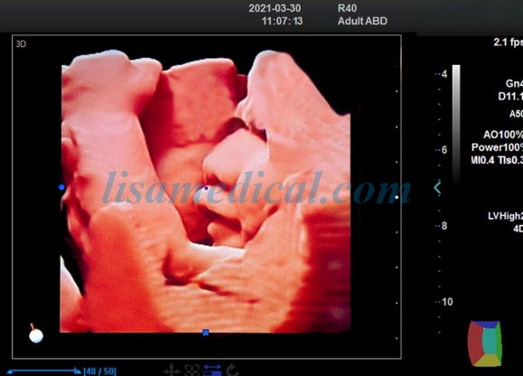ALS-P50 Portable Color Ultrasound