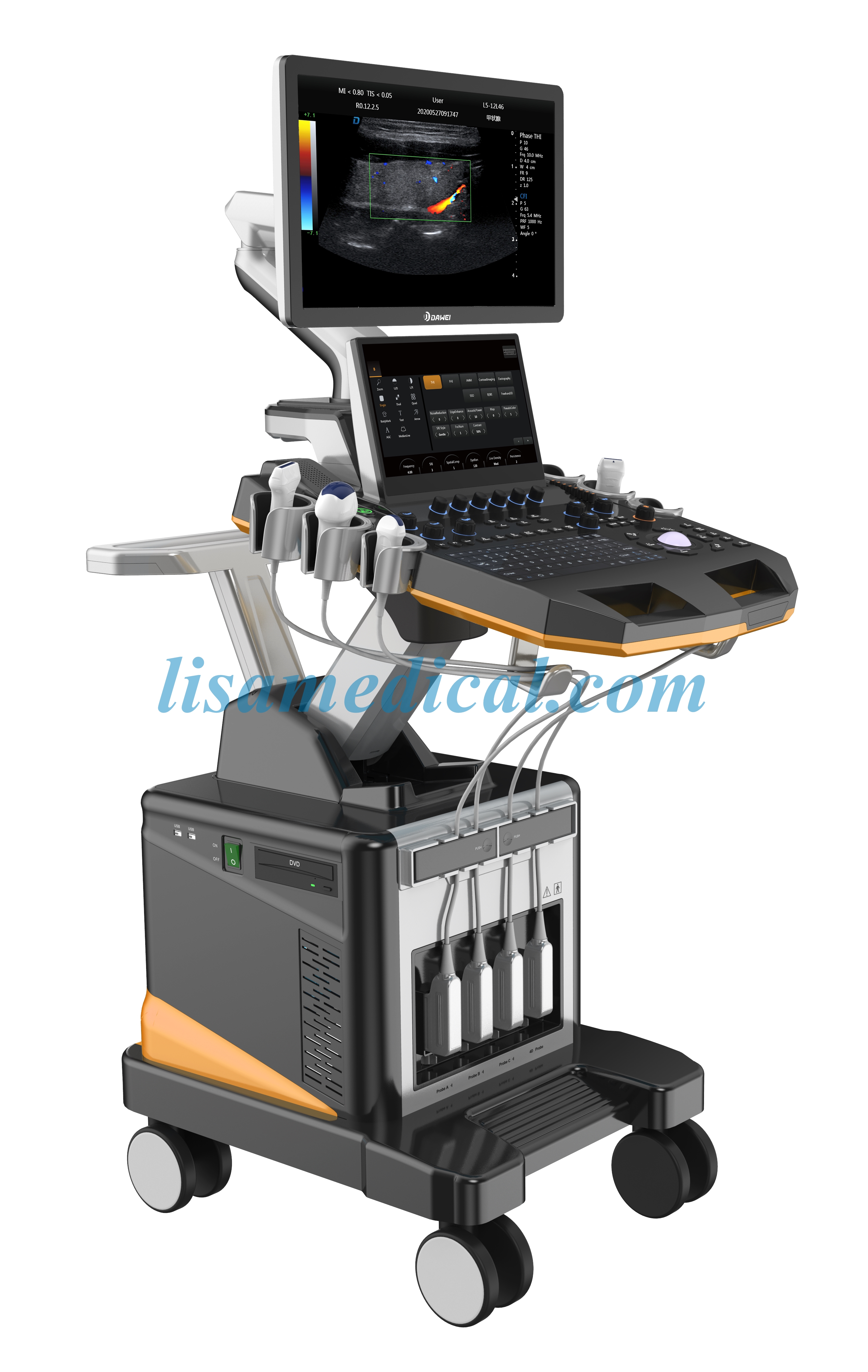 Ultrasound Innovation: Suppliers Maintain a Competitive Edge