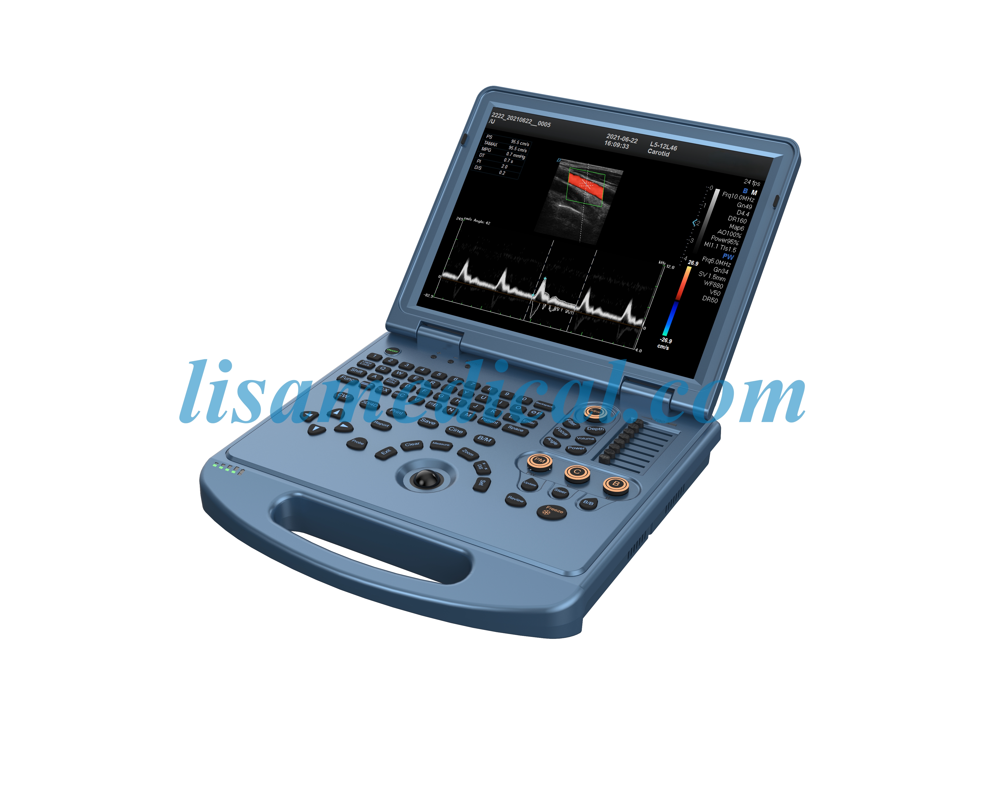ALS-L50 Color Ultrasonic