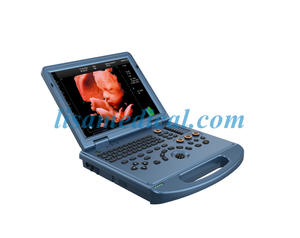 ALS-L50 Color Ultrasonic