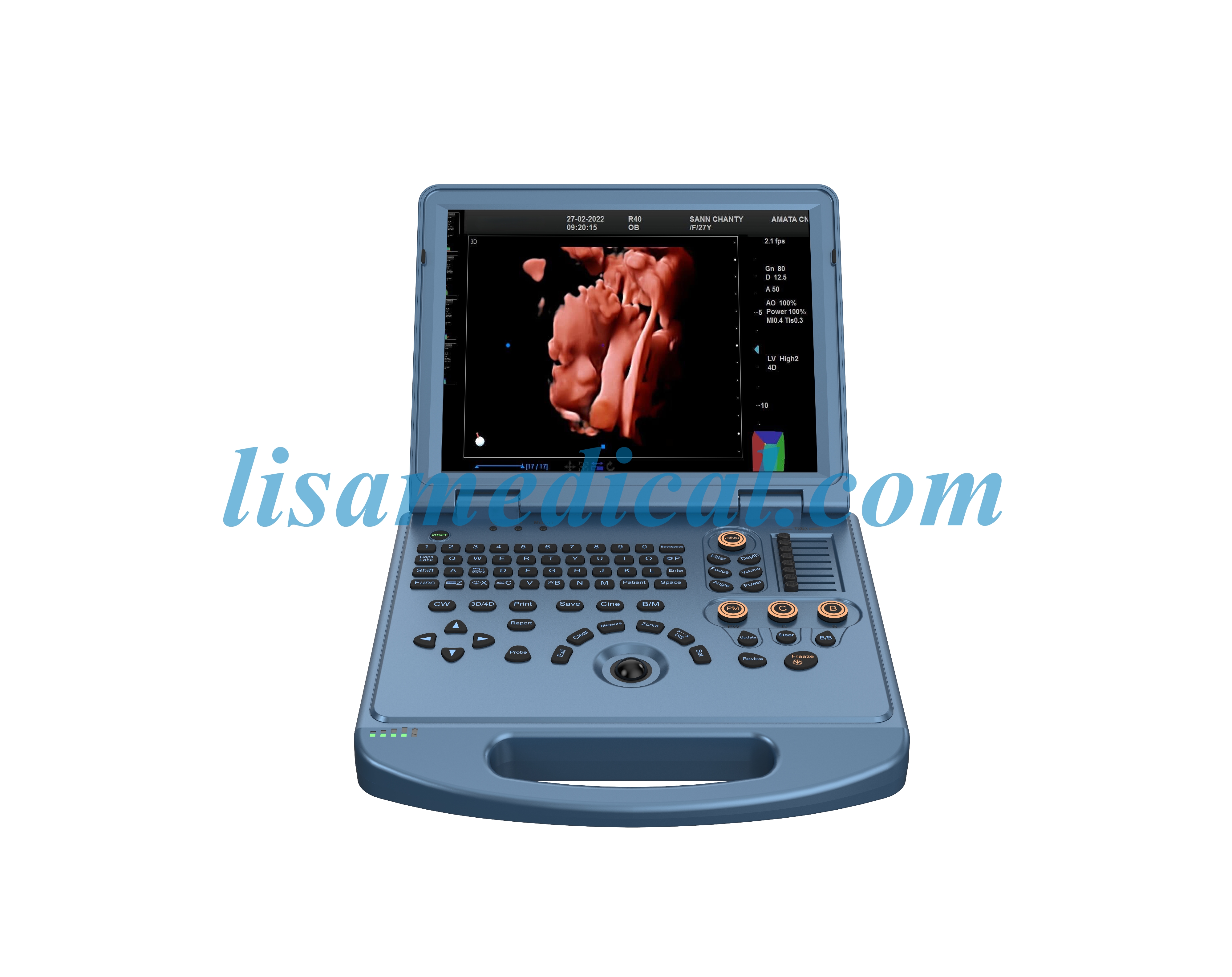ALS-L50 Color Ultrasonic