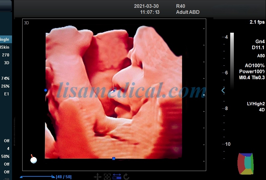 ALS-L50 Color Ultrasonic