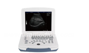 ALS-580 Black And White Ultrasonic