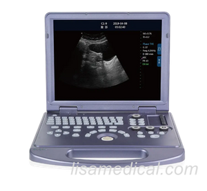 ALS-360 Black And White Ultrasonic