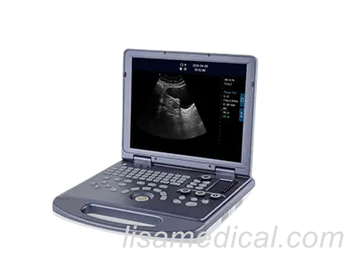 ALS-360 Black And White Ultrasonic